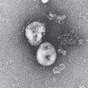 Características epidemiológicas y clínicas de 99 casos de neumonía por el nuevo coronavirus 2019 en Wuhan, China: un estudio descriptivo.